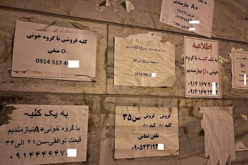 عضو بدن شما را خریداریم! عضو بدن شما را خریداریم!