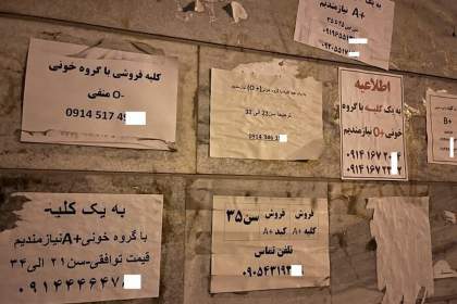 عضو بدن شما را خریداریم!